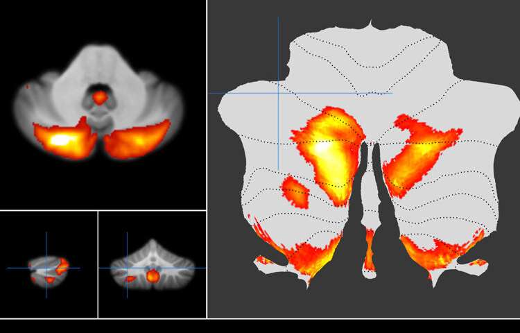 Scientists map our underappreciated ‘little brain’